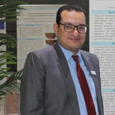 د. زكي فتوح راشد Dr. Zaky Ftouh Zaky Rashed